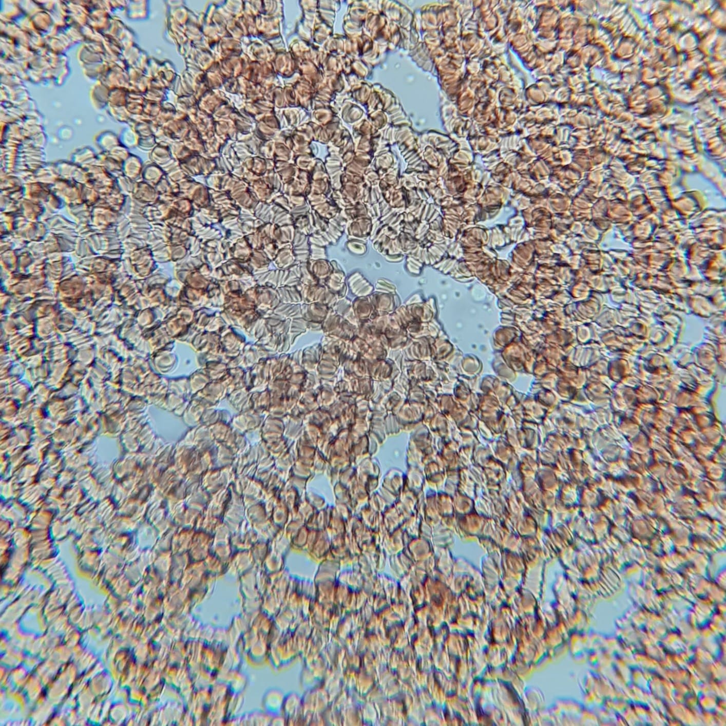 OMAX 40X-2000X Lab LED Binocular Compound Microscope with Double Layer Mechanical Stage and Coaxial Coarse/Fine Focusing Knob customer photo 2