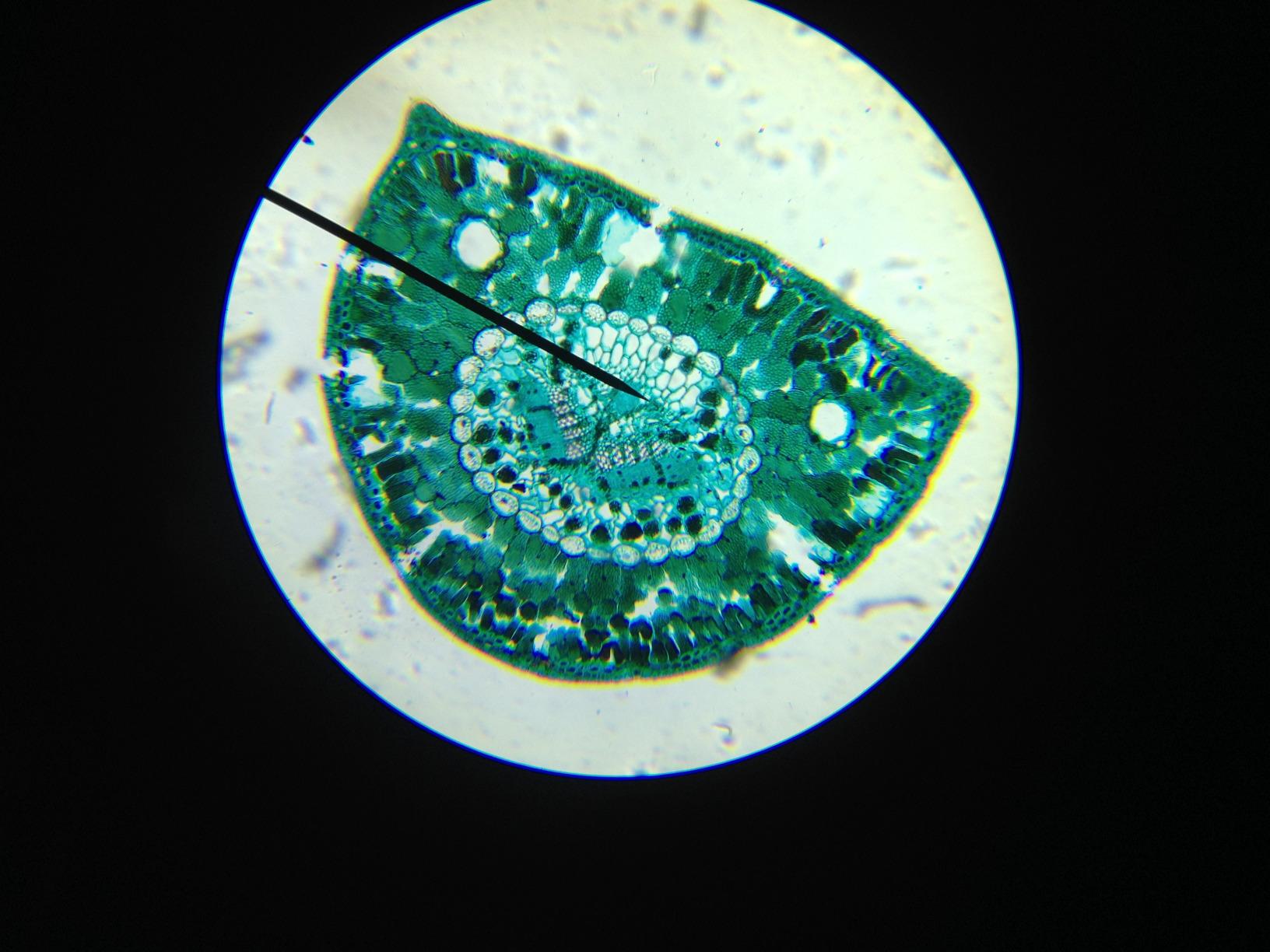 AmScope M158C Cordless Compound Monocular Microscope, WF10x and WF25x, 40X-1000X Magnification Range, Cordless Battery Powered Built-In LED Illumination customer photo 1