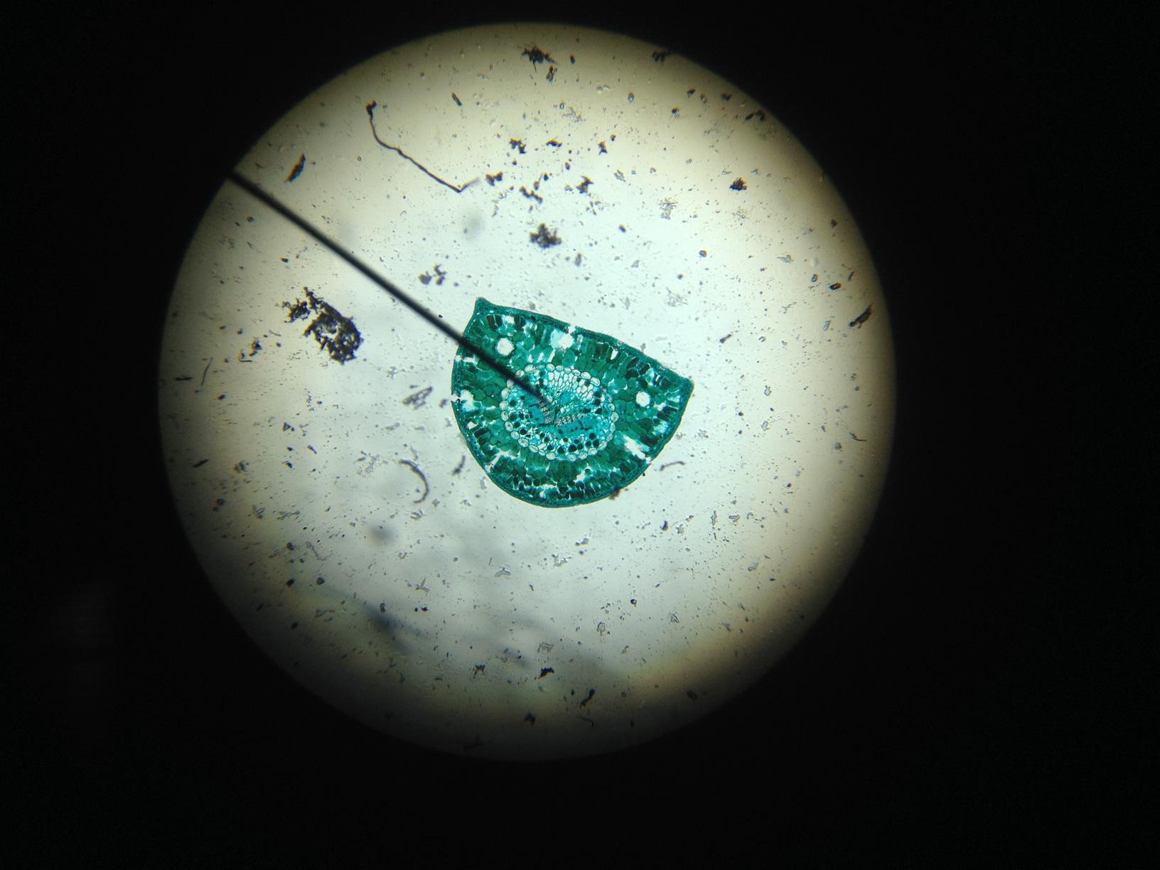 AmScope M158C Cordless Compound Monocular Microscope, WF10x and WF25x, 40X-1000X Magnification Range, Cordless Battery Powered Built-In LED Illumination customer photo 2
