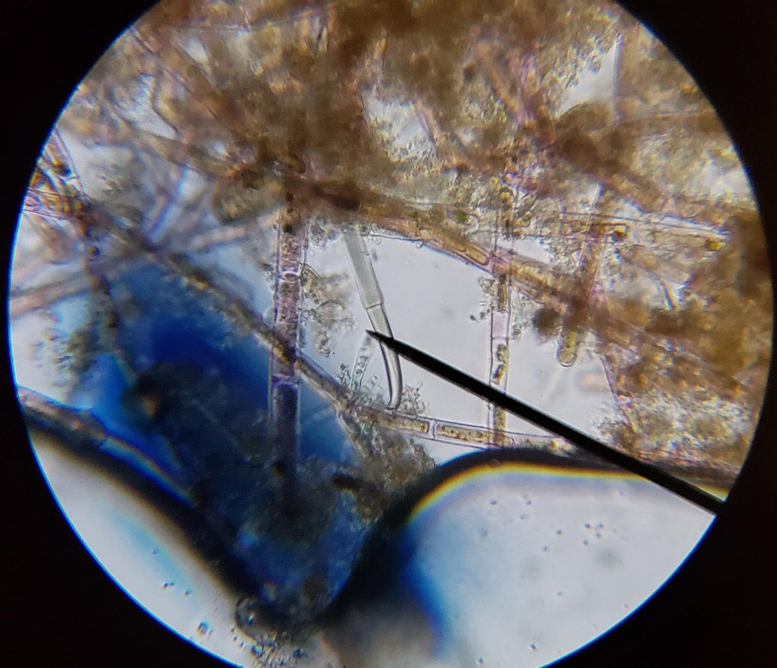 AmScope M150C1000X All-Metal Optical Glass Lenses Cordless LED 40X-1000X Compound Biological Microscope customer photo 1