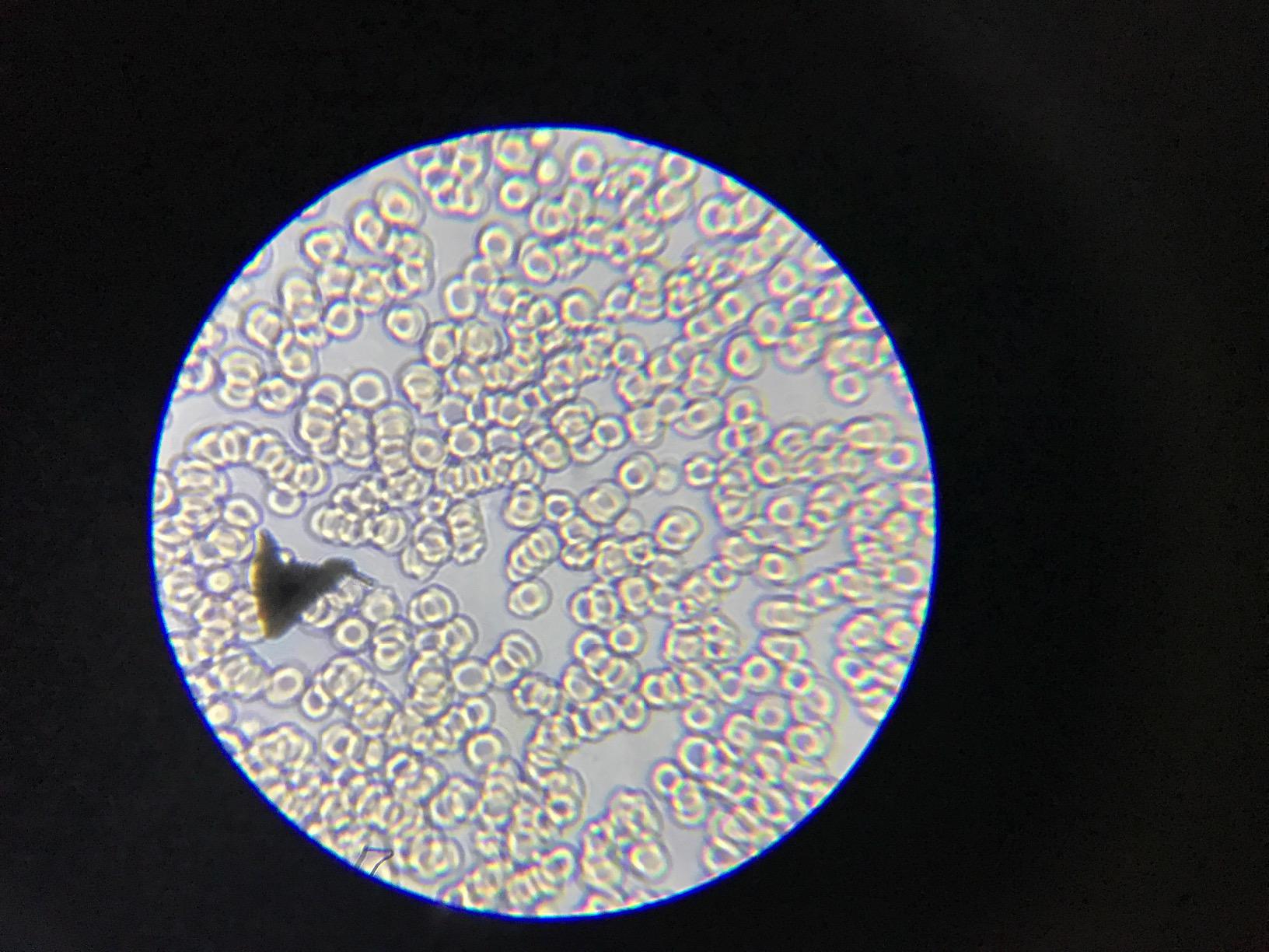 AmScope M162C-2L-PB10 1000X Dual Light Glass Lens Metal Frame Microscope | 40X-1000X Magnification Range customer photo 1