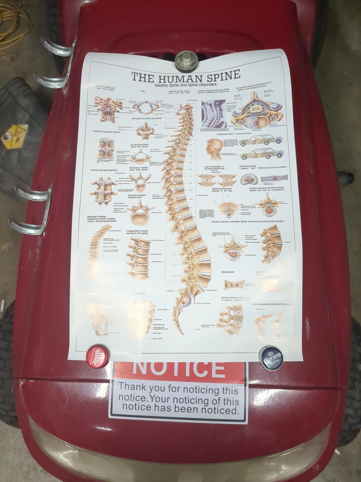 NLShan Human Skeleton Model for Anatomy: Scientific Model with Movable Arms, Legs & Display Stand - 17