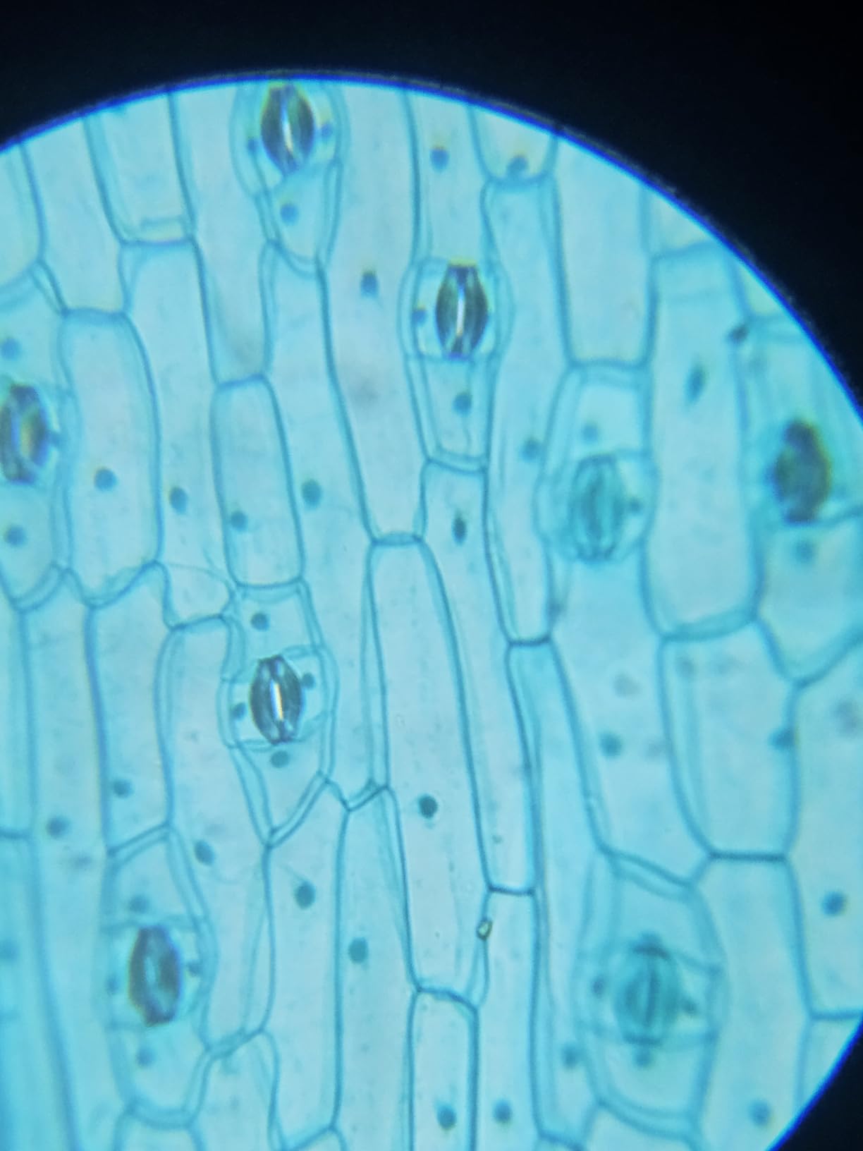 Microscope for Adults Professional: Compound Microscope 100X-2000X with Prepared Slides and Covers, Plant Stereo Microscopes for Homeschool Lab customer photo 2