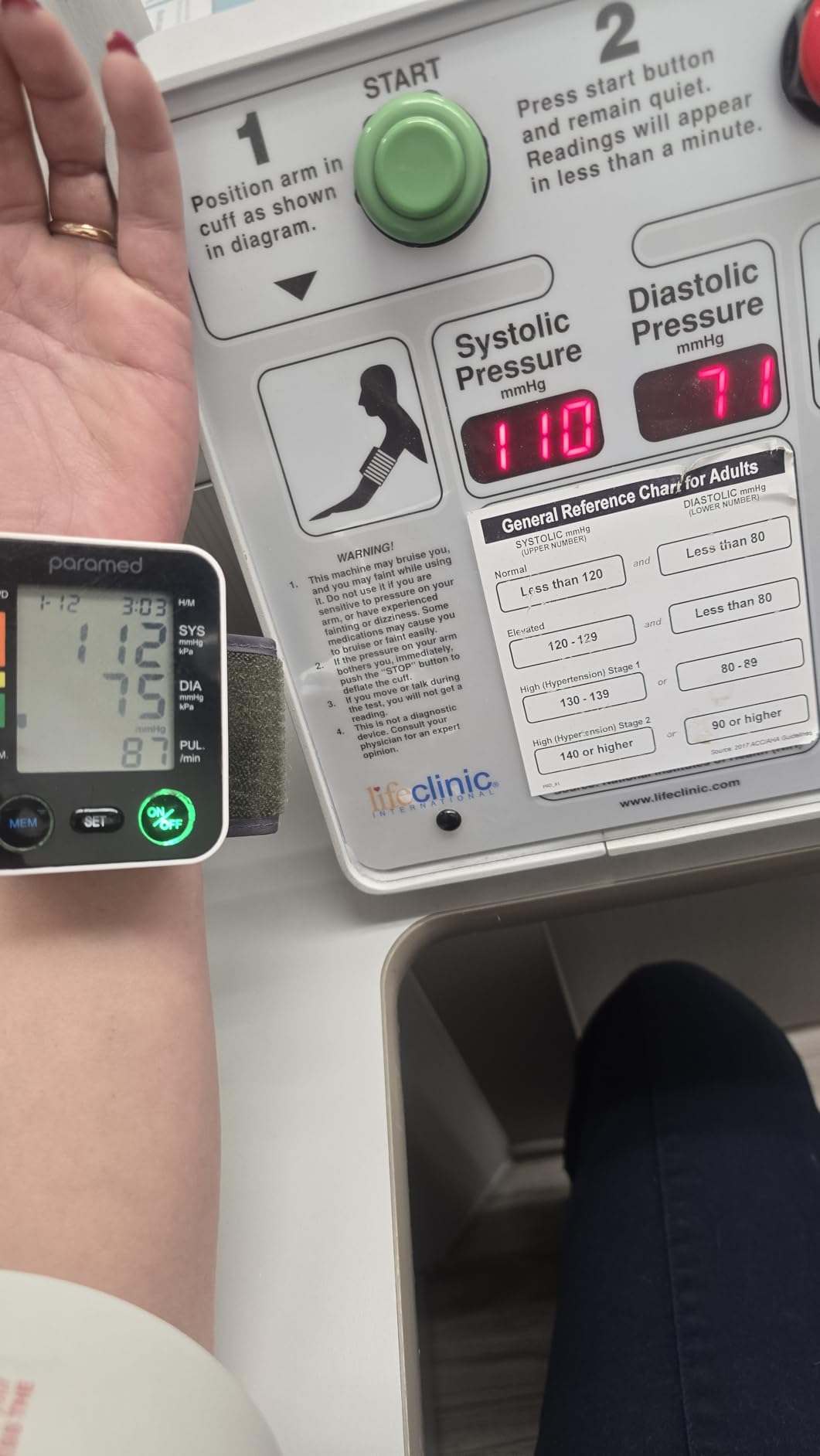 PARAMED Automatic Wrist Blood Pressure Monitor: Blood-Pressure Kit of Bp Cuff + 2AAA and Carrying case - Irregular Heartbeat Detector & 90 Readings Memory Function & Large Display customer photo 1
