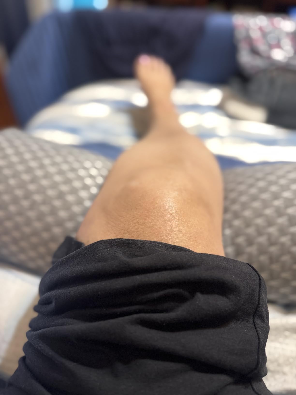 5 STARS UNITED Knee Pillow for Back Sleeping - Half Moon Bolster Pillow for Legs, Under Knee Pillow for Sleeping on Back customer photo 1