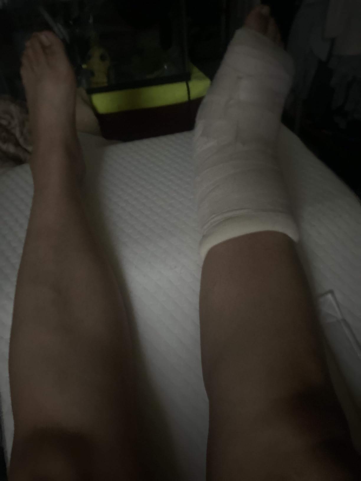 Ruqmuis Leg Elevation Pillow for After Surgery, 8inch Foam Leg Elevating Pillow for Swelling and Blood Circulation, Leg Wedge Pillow for Sleeping, Knee Pillow for Knee Hip Ankle Pain Relief, White customer photo 2