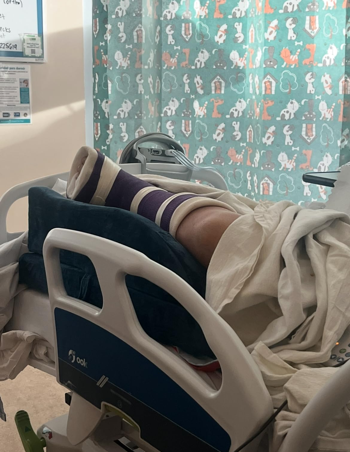 TranquilRelax Leg Elevation Pillow for After Surgery, Wedge Pillow, Grey | Single-leg design, adjustable height, U-shaped cradle, supportive memory foam, washable cover, leg elevation for swelling customer photo 2