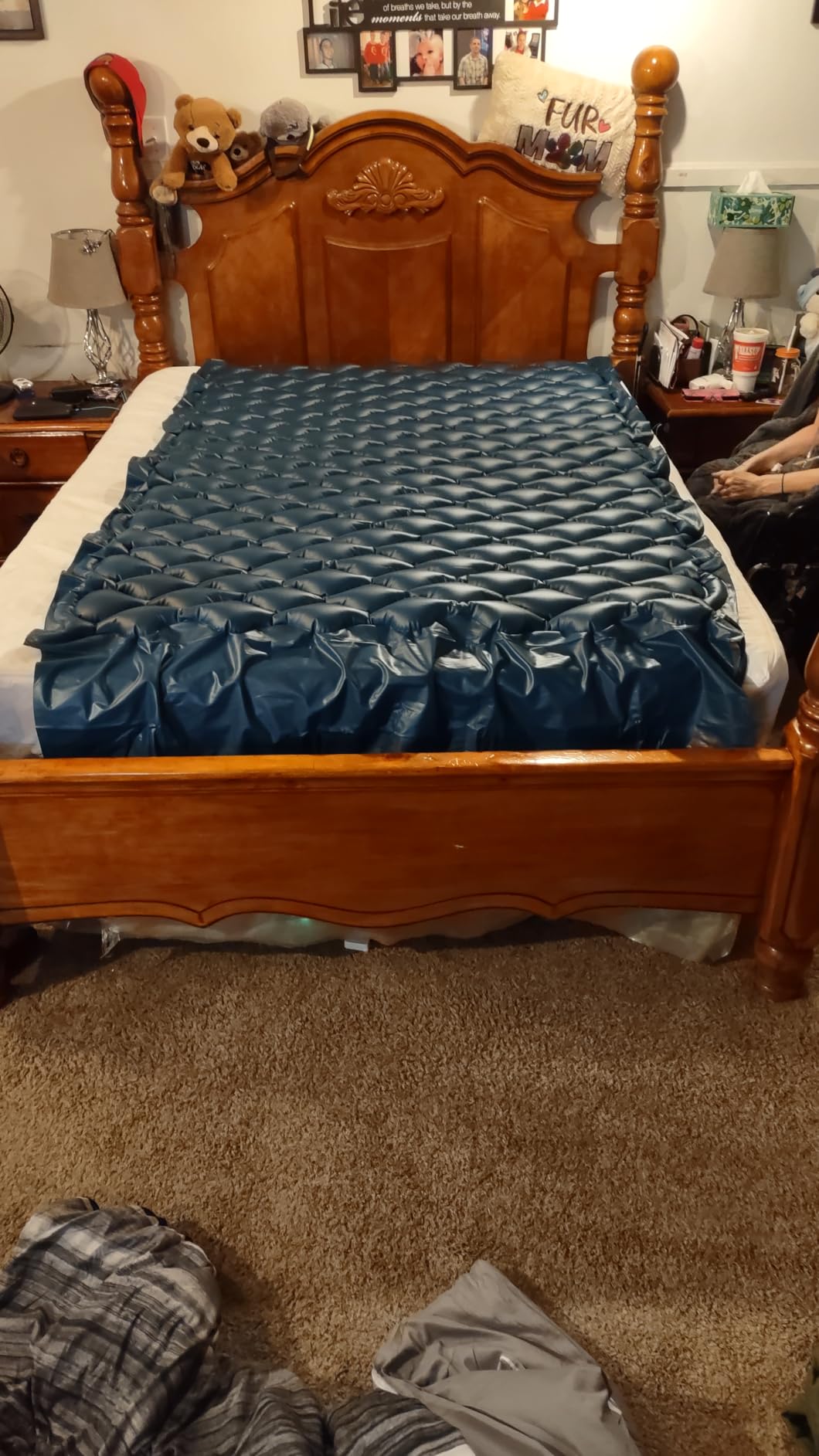 Lunderg Alternating Air Pressure Mattress Pad with Static Mode & Quiet Pump | Comfortable Bed Sore Prevention - Includes Waterproof Mattress Topper for Hospital Bed or Home customer photo 1